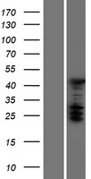 TRIP4 / ASC-1 Protein - Western validation with an anti-DDK antibody * L: Control HEK293 lysate R: Over-expression lysate