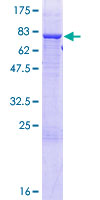 TRIT1 Protein - 12.5% SDS-PAGE of human TRIT1 stained with Coomassie Blue