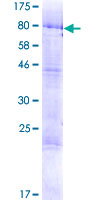 TRM6 / TRMT6 Protein - 12.5% SDS-PAGE of human TRMT6 stained with Coomassie Blue