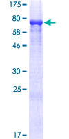 TRMO / C9orf156 Protein - 12.5% SDS-PAGE of human C9orf156 stained with Coomassie Blue