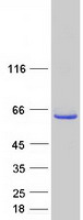 TRMO / C9orf156 Protein - Purified recombinant protein TRMO was analyzed by SDS-PAGE gel and Coomassie Blue Staining