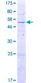 TRMT10C / RG9MTD1 Protein - 12.5% SDS-PAGE of human RG9MTD1 stained with Coomassie Blue
