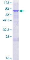 TRMT11 Protein - 12.5% SDS-PAGE of human C6orf75 stained with Coomassie Blue