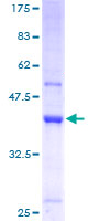 TRMT112 Protein - 12.5% SDS-PAGE of human HSPC152 stained with Coomassie Blue