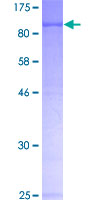 TRMT2A Protein - 12.5% SDS-PAGE of human TRMT2A stained with Coomassie Blue