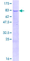 TRMT2B Protein - 12.5% SDS-PAGE of human CXorf34 stained with Coomassie Blue