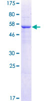 TRMT61A / TRM61 Protein - 12.5% SDS-PAGE of human C14orf172 stained with Coomassie Blue