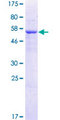 TRMT61A / TRM61 Protein - 12.5% SDS-PAGE of human C14orf172 stained with Coomassie Blue