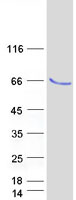 TRMT61B Protein - Purified recombinant protein TRMT61B was analyzed by SDS-PAGE gel and Coomassie Blue Staining