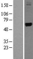 TRMU Protein - Western validation with an anti-DDK antibody * L: Control HEK293 lysate R: Over-expression lysate