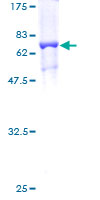 TRNT1 / CCA1 Protein - 12.5% SDS-PAGE of human TRNT1 stained with Coomassie Blue