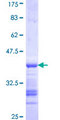 TROAP Protein - 12.5% SDS-PAGE Stained with Coomassie Blue.