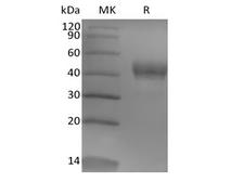 TROP2 / TACSTD2 Protein - Recombinant Human Tumor-associated Calcium Signal Transducer 2/TROP-2 (248AA, C-6His)
