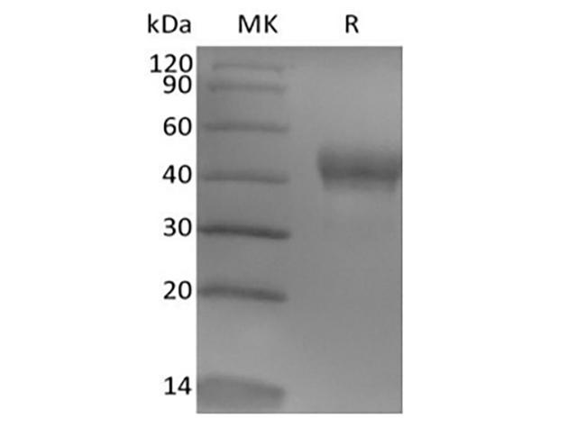 TROP2 / TACSTD2 Protein - Recombinant Human Tumor-associated Calcium Signal Transducer 2/TROP-2 (248AA, C-6His)