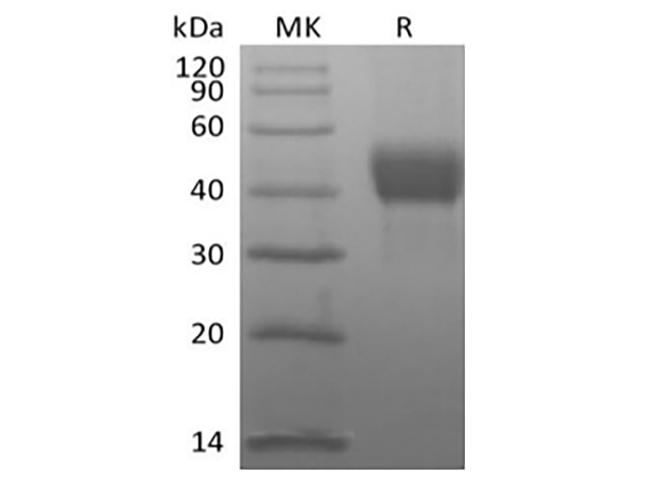 TROP2 / TACSTD2 Protein - Recombinant Human Tumor-associated Calcium Signal Transducer 2/TROP-2 (C-Avi-6His) Biotinylated