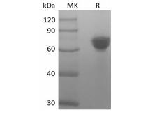 TROP2 / TACSTD2 Protein - Recombinant Human Tumor-associated Calcium Signal Transducer 2/TROP-2 (248AA, C-Fc)