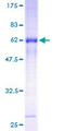 TROP2 / TACSTD2 Protein - 12.5% SDS-PAGE of human TACSTD2 stained with Coomassie Blue
