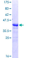 TROP2 / TACSTD2 Protein - 12.5% SDS-PAGE Stained with Coomassie Blue.