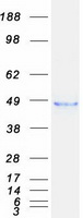 TROP2 / TACSTD2 Protein - Purified recombinant protein TACSTD2 was analyzed by SDS-PAGE gel and Coomassie Blue Staining