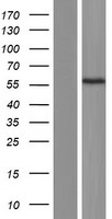 TROVE2 Protein - Western validation with an anti-DDK antibody * L: Control HEK293 lysate R: Over-expression lysate