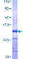 TROVE2 Protein - 12.5% SDS-PAGE Stained with Coomassie Blue.