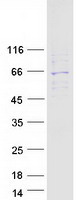 TROVE2 Protein - Purified recombinant protein TROVE2 was analyzed by SDS-PAGE gel and Coomassie Blue Staining