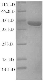 TRP32 / TXNL1 Protein - (Tris-Glycine gel) Discontinuous SDS-PAGE (reduced) with 5% enrichment gel and 15% separation gel.