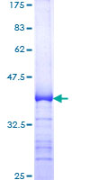 TRP32 / TXNL1 Protein - 12.5% SDS-PAGE Stained with Coomassie Blue.