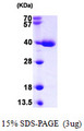 TRP32 / TXNL1 Protein