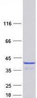 TRP32 / TXNL1 Protein - Purified recombinant protein TXNL1 was analyzed by SDS-PAGE gel and Coomassie Blue Staining