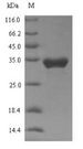 TRPA1 Protein - (Tris-Glycine gel) Discontinuous SDS-PAGE (reduced) with 5% enrichment gel and 15% separation gel.