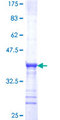 TRPA1 Protein - 12.5% SDS-PAGE Stained with Coomassie Blue.