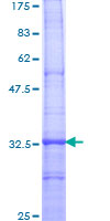 TRPC1 Protein - 12.5% SDS-PAGE Stained with Coomassie Blue.