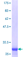 TRPC3 Protein - 12.5% SDS-PAGE Stained with Coomassie Blue.