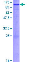 TRPC4AP / TRUSS Protein - 12.5% SDS-PAGE of human TRPC4AP stained with Coomassie Blue