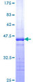 TRPC4AP / TRUSS Protein - 12.5% SDS-PAGE Stained with Coomassie Blue.