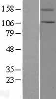TRPC5 Protein - Western validation with an anti-DDK antibody * L: Control HEK293 lysate R: Over-expression lysate