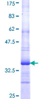 TRPC5 Protein - 12.5% SDS-PAGE Stained with Coomassie Blue.