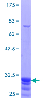 TRPC6 Protein - 12.5% SDS-PAGE Stained with Coomassie Blue.