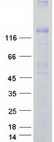 TRPM4 Protein - Purified recombinant protein TRPM4 was analyzed by SDS-PAGE gel and Coomassie Blue Staining