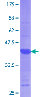 TRPM7 Protein - 12.5% SDS-PAGE Stained with Coomassie Blue.