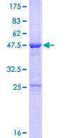 TRPT1 Protein - 12.5% SDS-PAGE of human TRPT1 stained with Coomassie Blue