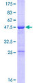 TRPT1 Protein - 12.5% SDS-PAGE of human TRPT1 stained with Coomassie Blue