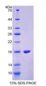 TRPV3 Protein - Recombinant  Transient Receptor Potential Cation Channel Subfamily V, Member 3 By SDS-PAGE
