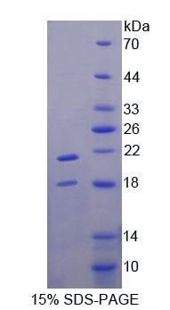 TRPV6 Protein - Recombinant Transient Receptor Potential Cation Channel Subfamily V, Member 6 By SDS-PAGE