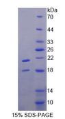 TRPV6 Protein - Recombinant Transient Receptor Potential Cation Channel Subfamily V, Member 6 By SDS-PAGE