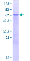TRUB1 Protein - 12.5% SDS-PAGE of human TRUB1 stained with Coomassie Blue