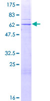 TRUB2 Protein - 12.5% SDS-PAGE of human TRUB2 stained with Coomassie Blue