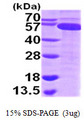 TRXR1 / TXNRD1 Protein