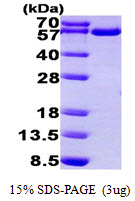 TRXR1 / TXNRD1 Protein